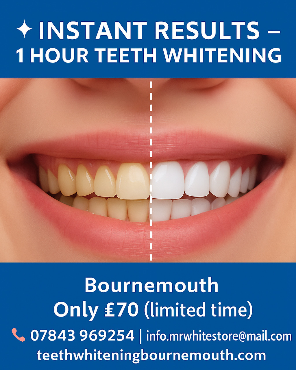 Mr White Teeth Whitening gallery image 2