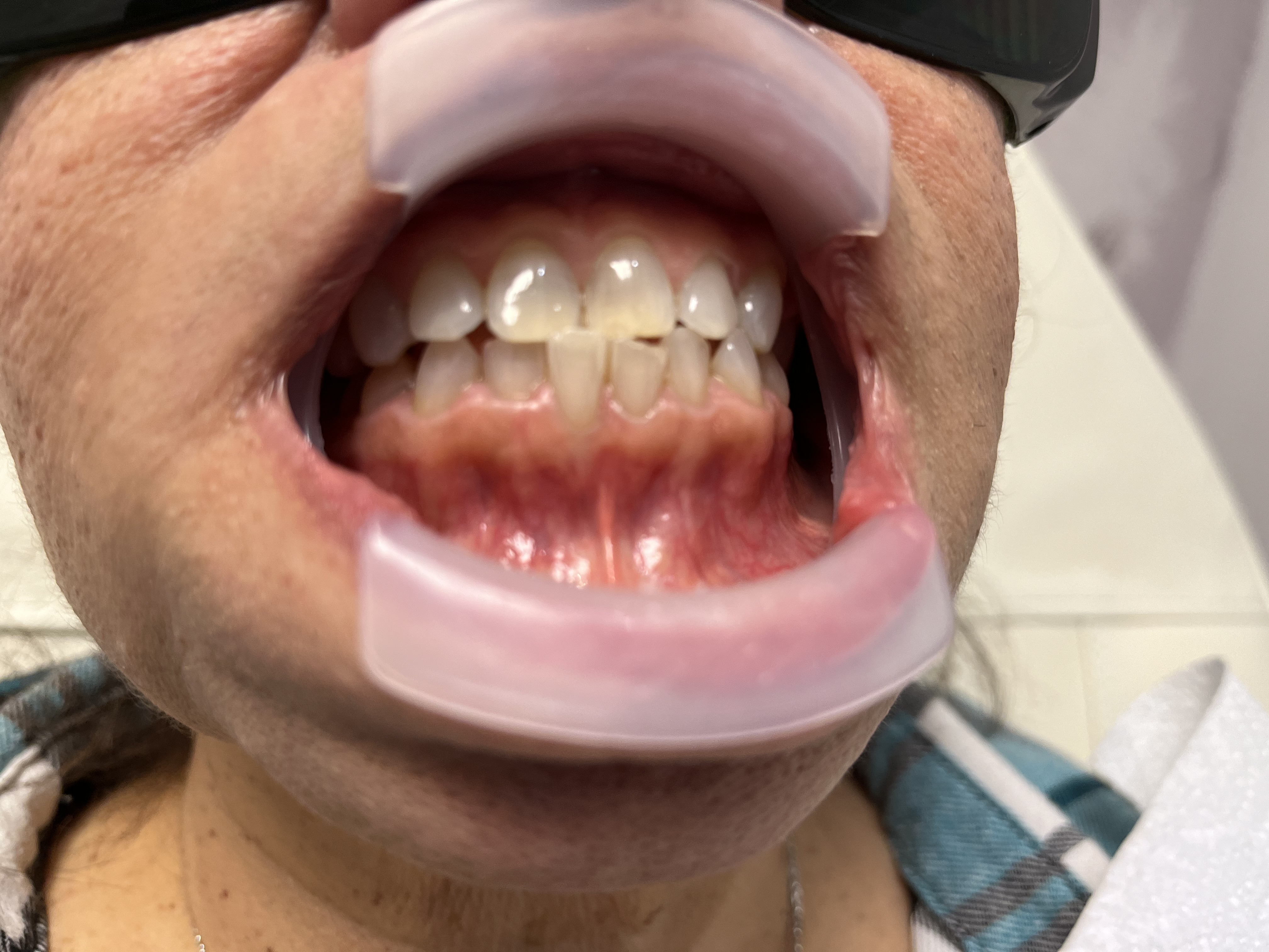 Mr White Teeth Whitening gallery image 7