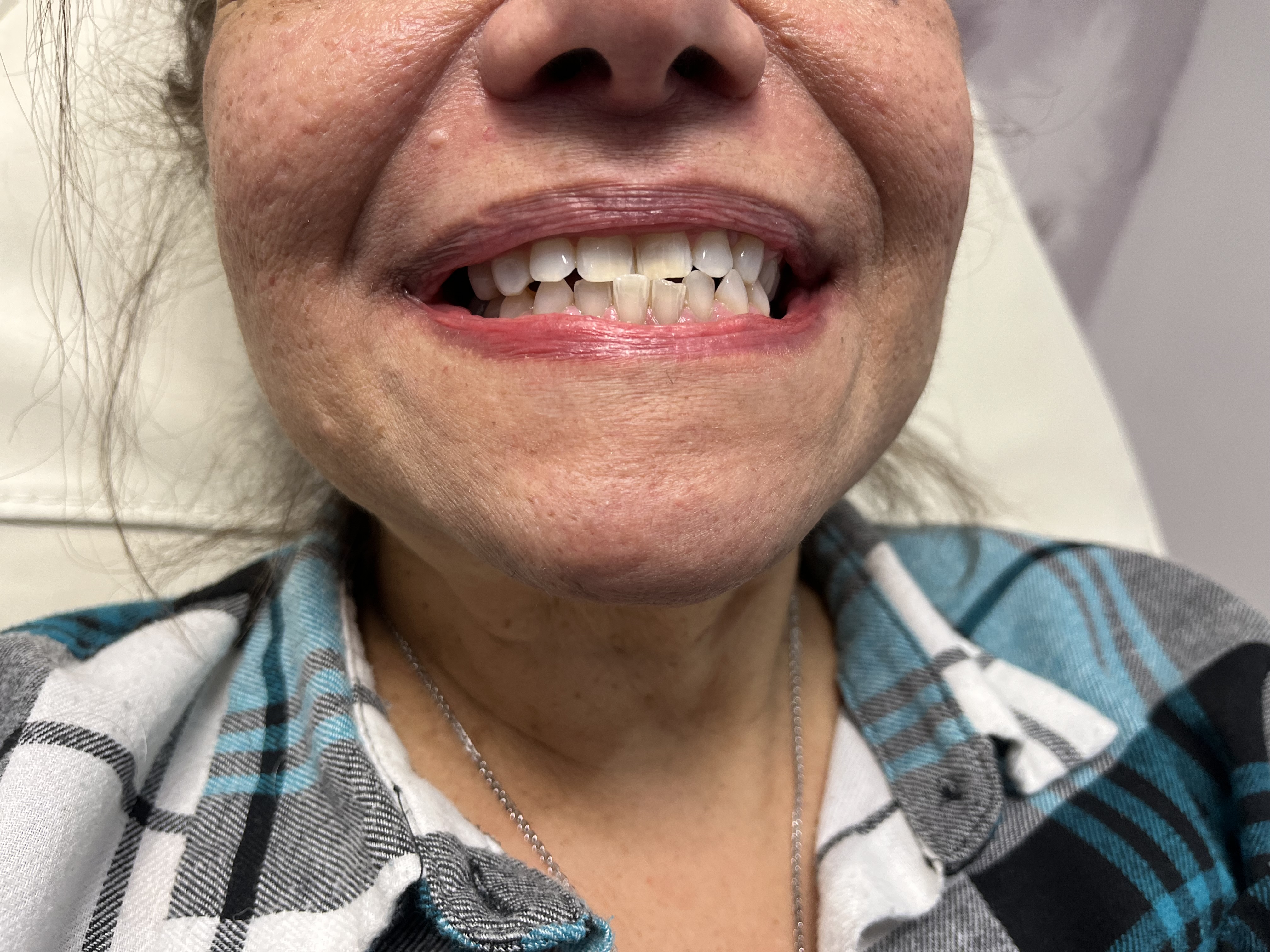 Mr White Teeth Whitening gallery image 8
