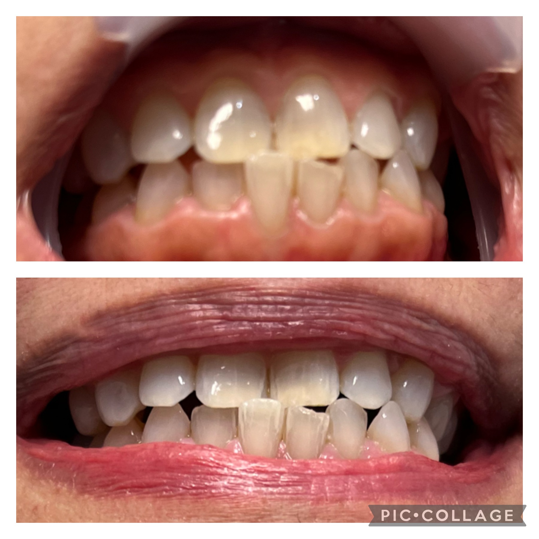 Mr White Teeth Whitening gallery image 9