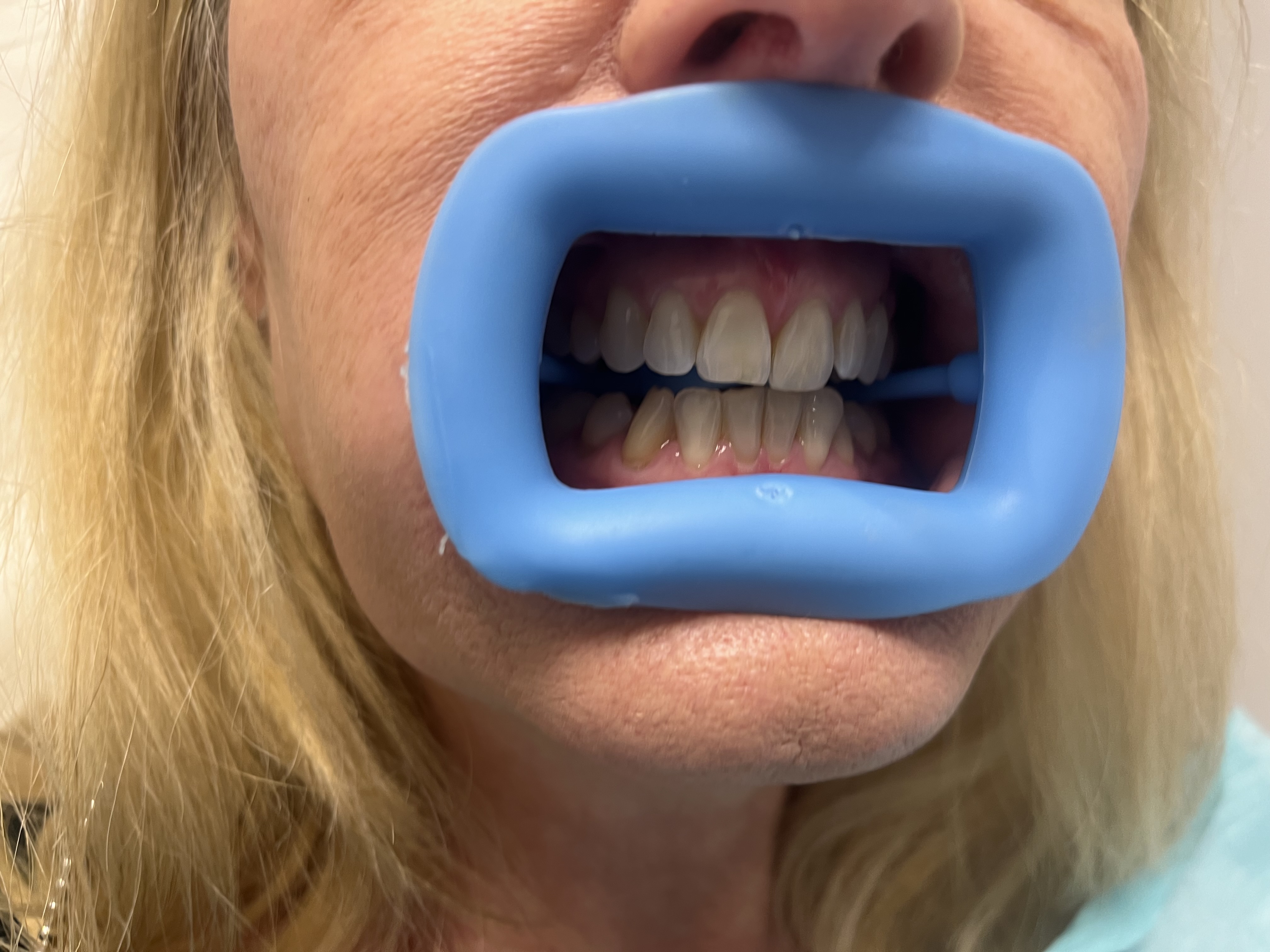 Mr White Teeth Whitening gallery image 10